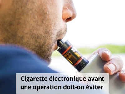 Cigarette électronique avant une opération, doit-on éviter ?