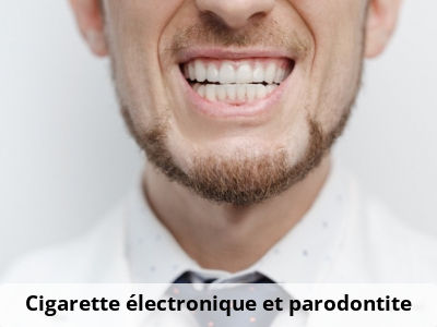 Cigarette électronique et parodontite