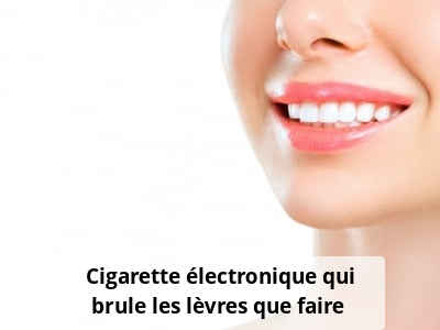 Cigarette électronique qui brûle les lèvres, que faire